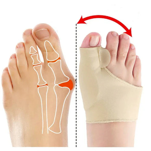HALLUX®️ Corrector Ortopédico de Juanetes. ¡Alivio, Corrección y Comodidad Garantizada! ☑️